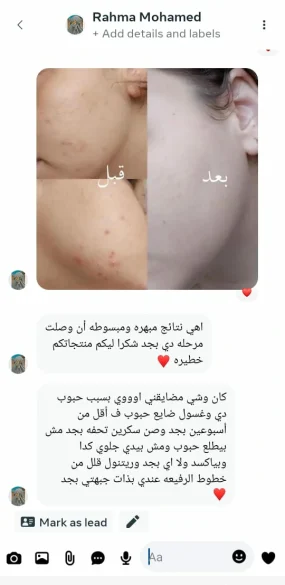 Glowmark Retinol serum